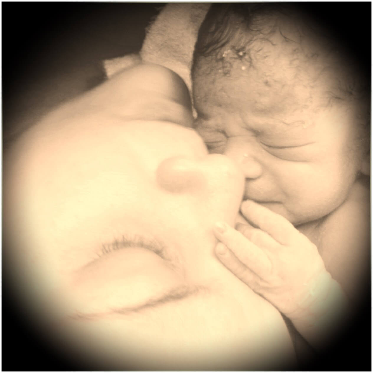 Mamá y bebé durante una cesárea